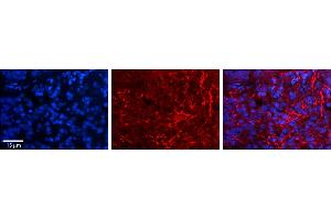 Immunohistochemistry (IHC) image for anti-Alanyl tRNA Synthetase (AARS) (C-Term) antibody (ABIN2778778)