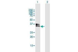 Western Blot analysis of SPRY1 expression in transfected 293T cell line by SPRY1 MaxPab polyclonal antibody. (SPRY1 Antikörper  (AA 1-319))