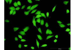 Immunofluorescence of purified MaxPab antibody to CUL1 on HeLa cell.