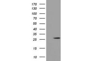 Western Blotting (WB) image for anti-OTU Domain, Ubiquitin Aldehyde Binding 2 (OTUB2) antibody (ABIN1499936) (OTUB2 Antikörper)