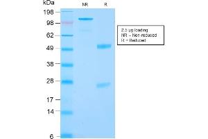 SDS-PAGE Analysis Purified RCC Rabbit Recombinant Monoclonal Antibody (CA9/2993R). (Rekombinanter CA9 Antikörper)