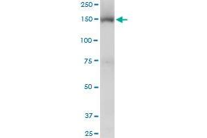 Viral Entry Inhibition (VEI) image for anti-Tripartite Motif Containing 33 (TRIM33) (AA 1006-1106) antibody (ABIN599250) (TRIM33 Antikörper  (AA 1006-1106))