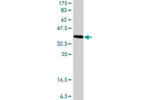 Western Blot detection against Immunogen (40. (FABP4 Antikörper  (AA 1-132))