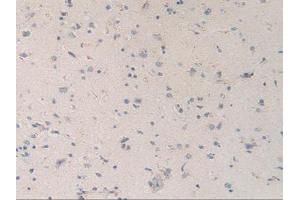 IHC-P analysis of Human Brain Tissue, with DAB staining. (MAPKAP Kinase 2 Antikörper  (AA 139-367))