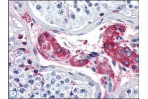 Human Testis (formalin-fixed, paraffin-embedded) stained with F12at 5 µg/ml followed by biotinylated anti-goat IgG secondary antibody, alkaline phosphatase-streptavidin and chromogen. (F12 Antikörper)