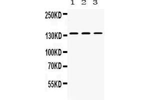 Western blot analysis of Nephrin expression in rat kidney extract ( Lane 1), mouse kidney extract ( Lane 2) and 293T whole cell lysates ( Lane 3). (Nephrin Antikörper  (AA 1084-1241))