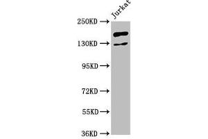 Western Blot Positive WB detected in: Jurkat whole cell lysate All lanes: CASZ1 antibody at 4. (CASZ1 Antikörper  (AA 127-266))
