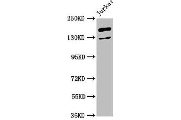 CASZ1 anticorps  (AA 127-266)