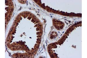 Immunohistochemical staining of paraffin-embedded Human breast tissue using anti-C1orf50 mouse monoclonal antibody. (C1ORF50 Antikörper)