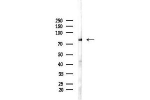 Western blot analysis of lysates from A375 cells(heat-shock,45 min treatment), using RSK2 Antibody at 1/1000 dilution.