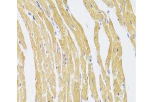 Immunohistochemistry of paraffin-embedded Mouse heart using CSRP3 Polyclonal Antibody at dilution of 1:100 (40x lens). (CSRP3 Antikörper)