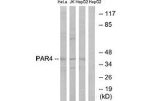 Western blot analysis of extracts from HepG2/Jurkat/HeLa cells, using PAR4 Antibody. (F2RL3 Antikörper  (AA 29-78))