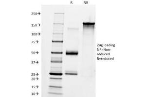 SDS-PAGE Analysis of Purified, BSA-Free Anti-IgM Antibody (clone IM260). (Maus anti-Human IgM Antikörper)