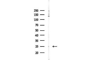 anti-CKLF-Like MARVEL Transmembrane Domain Containing 4 (CMTM4) (N-Term) antibody