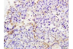 Formalin-fixed and paraffin embedded rat pancreas tissue labeled with Anti-MTUS1 Polyclonal Antibody, Unconjugated  at 1:200 followed by conjugation to the secondary antibody and DAB staining (MTUS1 Antikörper  (AA 1151-1270))