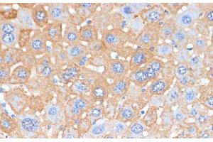 Immunohistochemistry of paraffin-embedded Mouse liver using APCS Polyclonal Antibody at dilution of 1:100 (40x lens). (APCS Antikörper)
