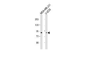 All lanes : Anti-SMURF2 Antibody at 1:2000-1:4000 dilution Lane 1: MDA-MB-231 whole cell lysate Lane 2: U-2OS whole cell lysate Lysates/proteins at 20 μg per lane. (SMURF2 Antikörper)