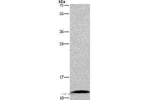 Western blot analysis of Mouse small intestine tissue, using FABP6 Polyclonal Antibody at dilution of 1:550 (FABP6 Antikörper)
