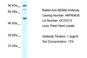 Western Blotting (WB) image for anti-Sestrin 2 (SESN2) (C-Term) antibody (ABIN786225) (Sestrin 2 Antikörper  (C-Term))