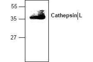Image no. 1 for anti-Cathepsin L1 (CTSL1) antibody (ABIN127049) (Cathepsin L Antikörper)