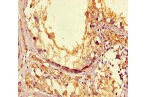 Immunohistochemistry of paraffin-embedded human testis tissue using ABIN7166656 at dilution of 1:100 (LPAL2 Antikörper  (AA 52-124))