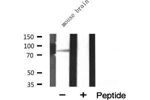 Western blot analysis of extracts from mouse brain, using MARK3 antibody. (MARK3 Antikörper  (N-Term))