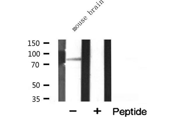 MARK3 Antikörper  (N-Term)