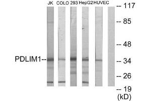 Western Blotting (WB) image for anti-PDZ and LIM Domain 1 (PDLIM1) (Internal Region) antibody (ABIN1848911) (PDLIM1 Antikörper  (Internal Region))