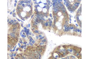 Immunohistochemistry analysis of paraffin-embedded mouse colon using FAS Monoclonal Antibody at dilution of 1:200.
