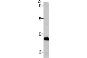 Western Blotting (WB) image for anti-Suppressor of Cytokine Signaling 1 (SOCS1) antibody (ABIN2426412) (SOCS1 Antikörper)