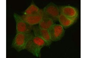 IF analysis of CTBP1 using anti-CTBP1 antibody (ABIN3043816) and anti-Tubulin Alpha antibody (ABIN7600339). (CTBP1 Antikörper  (C-Term))