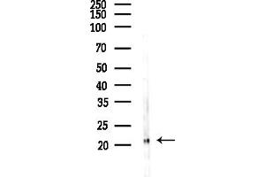 anti-Glutathione Peroxidase 4 (GPX4) (C-Term) antibody
