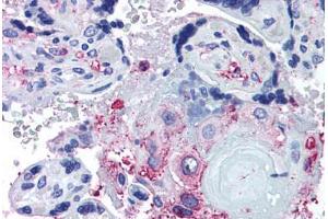 Immunohistochemistry (IHC) image for anti-ADAM Metallopeptidase with thrombospondin Type 1 Motif, 5 (ADAMTS5) (Internal Region) antibody (ABIN1048293)