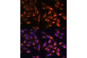Immunofluorescence analysis of U-2 OS cells using PTCD1 antibody (ABIN7269203) at dilution of 1:100. (PTCD1 Antikörper  (AA 435-537))