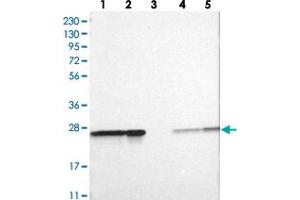 Western blot analysis of Lane 1: RT-4, Lane 2: U-251 MG, Lane 3: Human Plasma, Lane 4: Liver, Lane 5: Tonsil with PSMA2 polyclonal antibody . (PSMA2 Antikörper)