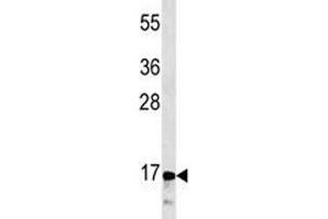 CGRP antibody western blot analysis in CEM lysate (CGRP Antikörper  (AA 56-84))