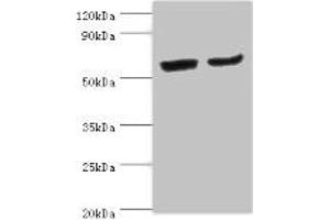 Western blot All lanes: CYP2J2 antibody at 4 μg/mL Lane 1: Mouse skeletal muscle tissue Lane 2: Rat liver tissue Secondary Goat polyclonal to rabbit IgG at 1/10000 dilution Predicted band size: 58 kDa Observed band size: 58 kDa (CYP2J2 Antikörper  (AA 328-502))