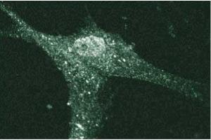 Immunofluorescent staining of Human Fibroblasts with anti-Cadherin-5 antibody.