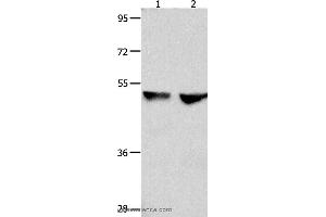 Western blot analysis of 823 and Hela cell , using CDK9 Polyclonal Antibody at dilution of 1:300 (CDK9 Antikörper)