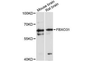 Western blot analysis of extracts of various cell lines, using FBXO31 antibody (ABIN6291619) at 1:3000 dilution. (FBXO31 Antikörper)