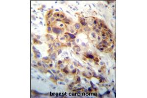 Immunohistochemistry (Paraffin-embedded Sections) (IHC (p)) image for anti-Peptidase Inhibitor 15 (PI15) (AA 34-63), (N-Term) antibody (ABIN657253)