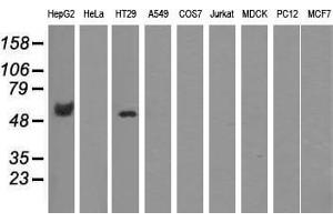 Western blot analysis of extracts (35 µg) from 9 different cell lines by using anti-CORO1B monoclonal antibody.