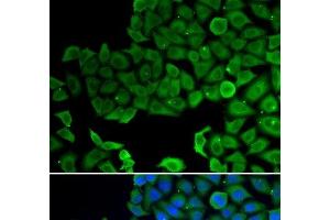 Immunofluorescence analysis of A549 cells using VPS4A Polyclonal Antibody (VPS4A Antikörper)