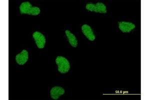 Immunofluorescence of monoclonal antibody to PPARBP on HeLa cell. (MED1 Antikörper  (AA 1391-1490))