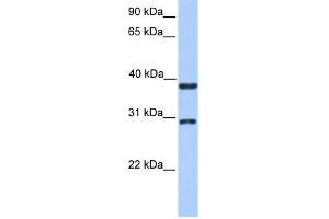WB Suggested Anti-KLHDC1 Antibody Titration: 0. (KLHDC1 Antikörper  (N-Term))