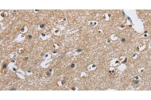 Immunohistochemistry of paraffin-embedded Human brain using CAB39L Polyclonal Antibody at dilution of 1:40 (CAB39L Antikörper)