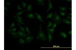 Image no. 3 for anti-Zic Family Member 4 (ZIC4) (AA 249-320) antibody (ABIN466251) (ZIC4 Antikörper  (AA 249-320))