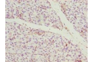 Immunohistochemistry of paraffin-embedded human pancreatic tissue using ABIN7148168 at dilution of 1:100 (CCDC89 Antikörper  (AA 1-200))