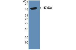 Western blot analysis of recombinant Human ADCYAP1. (PACAP Antikörper  (AA 17-176))