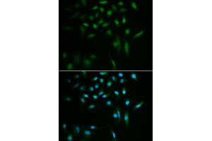 Immunofluorescence analysis of A549 cells using SUMO3 antibody (ABIN5971585). (SUMO3 Antikörper)